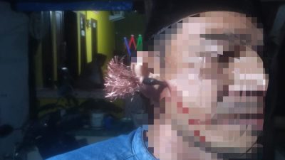 Warga Ongkoe Jadi Korban Pembusuran Saat Duduk Di Teras Rumah